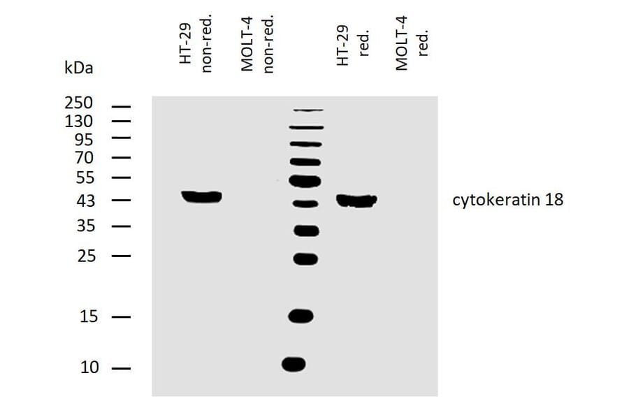 WB - Anti-Cytokeratin 18 Antibody [DA-7] (A86584)