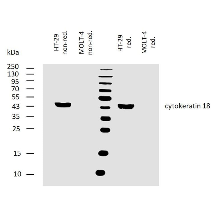 WB - Anti-Cytokeratin 18 Antibody [DA-7] (A86584)