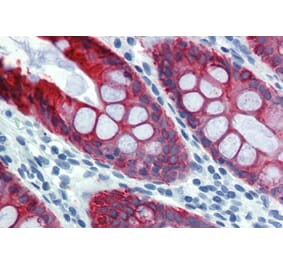 Immunohistochemistry - Anti-Cytokeratin 18 Antibody [DA-7] (A86581) - Antibodies.com