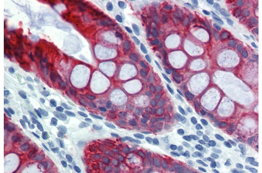 Immunohistochemistry - Anti-Cytokeratin 18 Antibody [DA-7] (A86581) - Antibodies.com