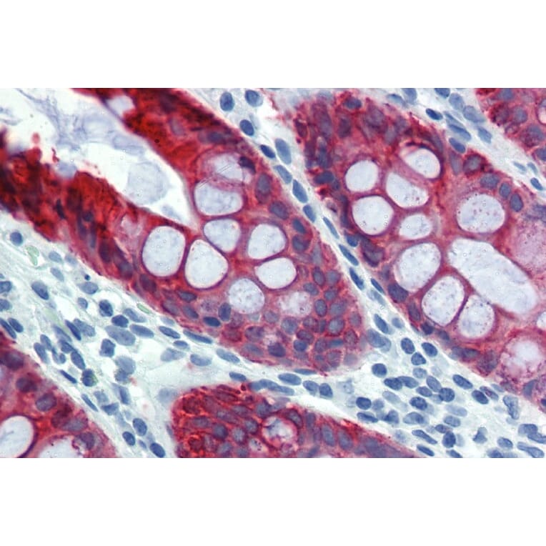 Immunohistochemistry - Anti-Cytokeratin 18 Antibody [DA-7] (A86581) - Antibodies.com