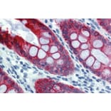 Immunohistochemistry - Anti-Cytokeratin 18 Antibody [DA-7] (A86581) - Antibodies.com