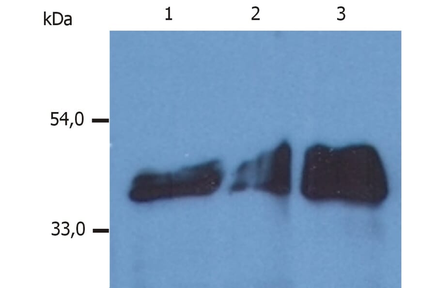 Western Blot - Anti-Cytokeratin 18 Antibody [DA-7] (A86584) - Antibodies.com