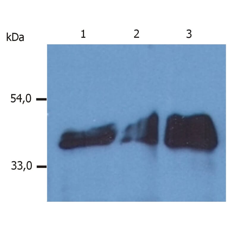 Western Blot - Anti-Cytokeratin 18 Antibody [DA-7] (A86584) - Antibodies.com