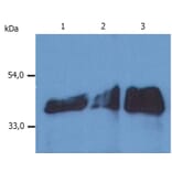 Western Blot - Anti-Cytokeratin 18 Antibody [DA-7] (A86584) - Antibodies.com