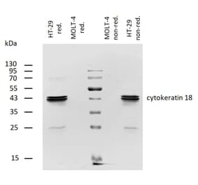 WB - Anti-Cytokeratin 18 Antibody [DA-7] (Biotin) (A86585)