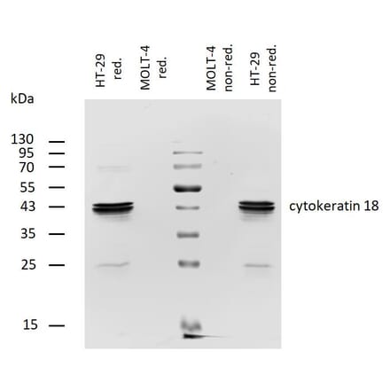 WB - Anti-Cytokeratin 18 Antibody [DA-7] (Biotin) (A86585)