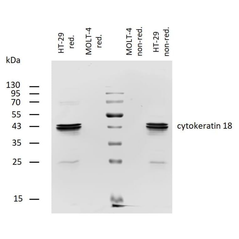 WB - Anti-Cytokeratin 18 Antibody [DA-7] (Biotin) (A86585)