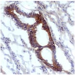 IHC - Anti-Nitrotyrosine Antibody [EM-30] (A86604)