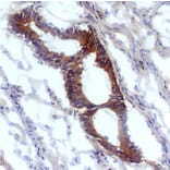 Immunohistochemistry - Anti-Nitrotyrosine Antibody [EM-30] (A86602) - Antibodies.com
