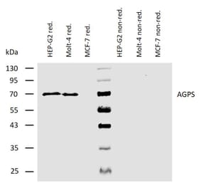 WB - Anti-AGPS Antibody [AGPS-03] (A86612)