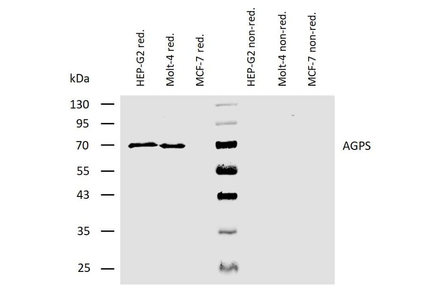 WB - Anti-AGPS Antibody [AGPS-03] (A86612)