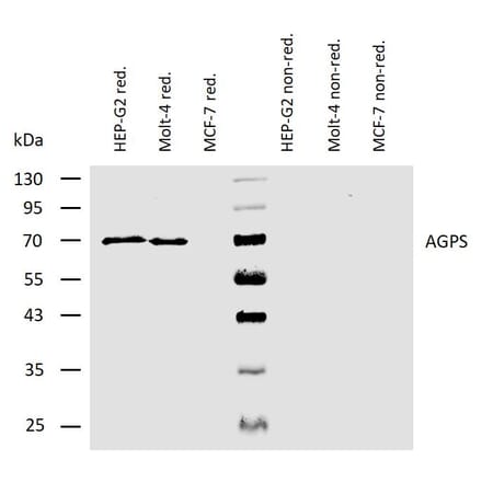 WB - Anti-AGPS Antibody [AGPS-03] (A86612)