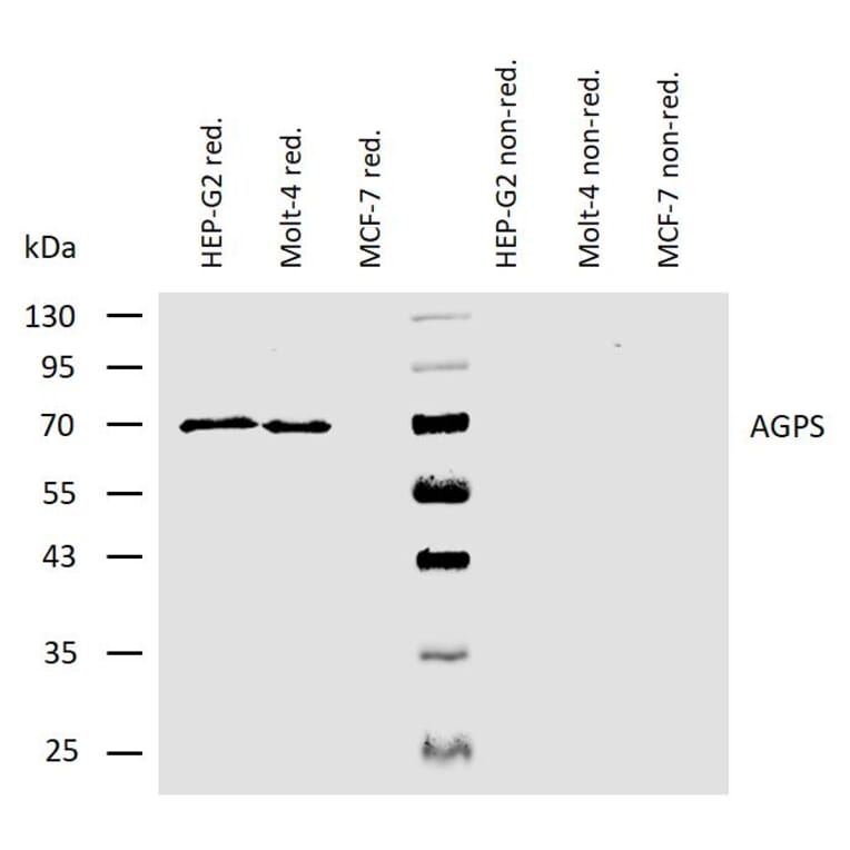 WB - Anti-AGPS Antibody [AGPS-03] (A86612)