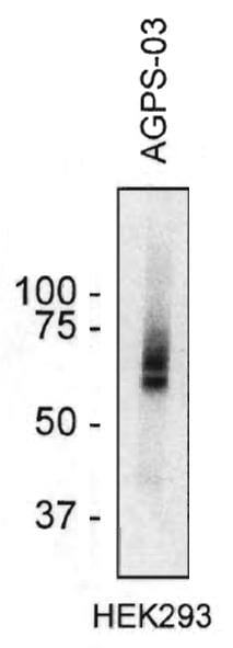 Western blotting analysis of AGPS in HEK293 cell lysate using Anti-AGPS Antibody (A86612).