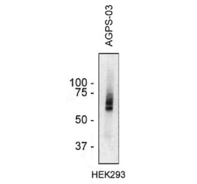 Western Blot - Anti-AGPS Antibody [AGPS-03] (A86609) - Antibodies.com