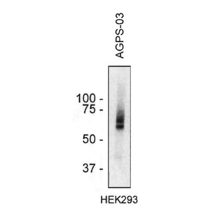 Western Blot - Anti-AGPS Antibody [AGPS-03] (A86609) - Antibodies.com