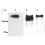 Western Blot - Anti-MAP2 Antibody [MT-08] (A86618) - Antibodies.com