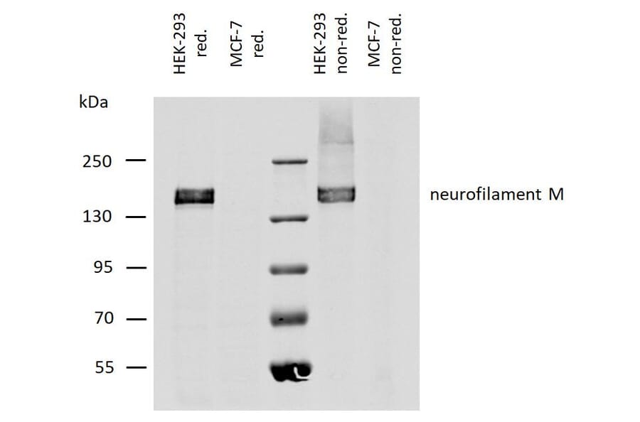 WB - Anti-Neurofilament M Antibody [NF-09] (A86621)