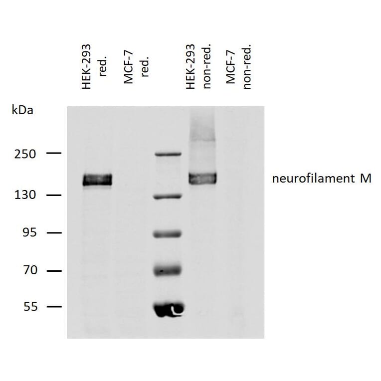 WB - Anti-Neurofilament M Antibody [NF-09] (A86621)