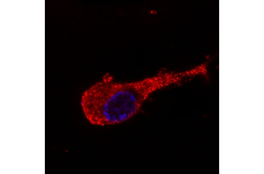 Immunocytochemistry - Anti-Neurofilament M Antibody [NF-09] (A86619) - Antibodies.com