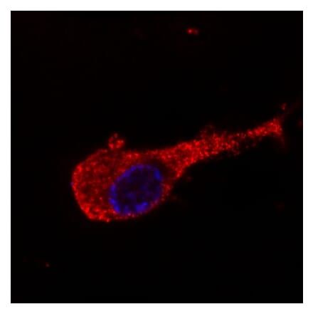 Immunocytochemistry - Anti-Neurofilament M Antibody [NF-09] (A86619) - Antibodies.com