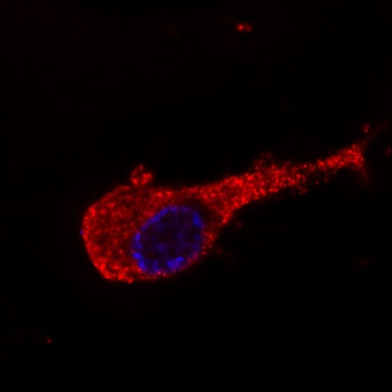 Immunocytochemistry - Anti-Neurofilament M Antibody [NF-09] (A86619) - Antibodies.com