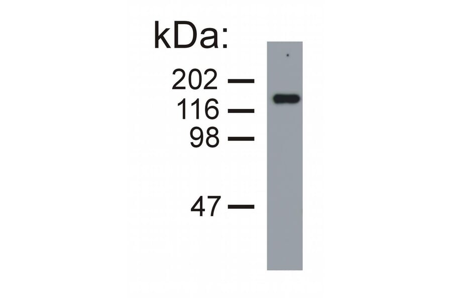 Western Blot - Anti-Neurofilament M Antibody [NF-09] (A86621) - Antibodies.com