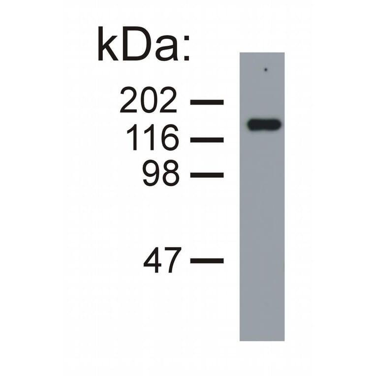 Western Blot - Anti-Neurofilament M Antibody [NF-09] (A86621) - Antibodies.com