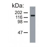 Western Blot - Anti-Neurofilament M Antibody [NF-09] (A86621) - Antibodies.com