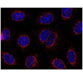 ICC - Anti-STIM1 Antibody [CDN3H4] (A86629)