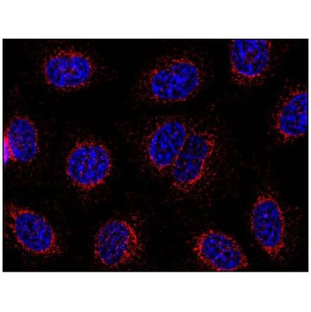 ICC - Anti-STIM1 Antibody [CDN3H4] (A86629)