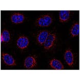 ICC - Anti-STIM1 Antibody [CDN3H4] (A86629)