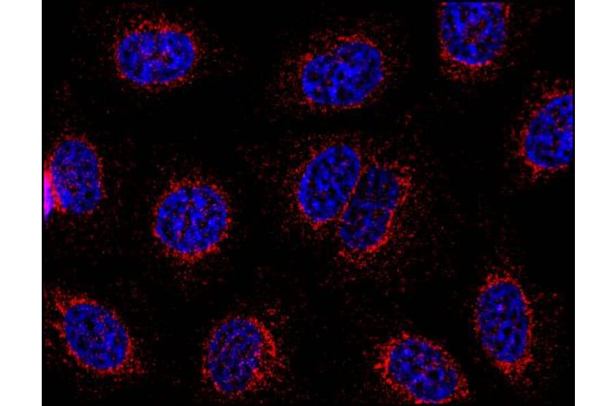 Immunocytochemistry - Anti-STIM1 Antibody [CDN3H4] (A86626) - Antibodies.com