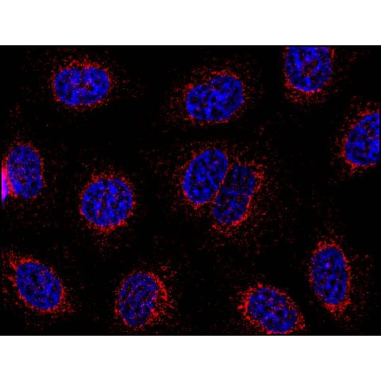 Immunocytochemistry - Anti-STIM1 Antibody [CDN3H4] (A86626) - Antibodies.com