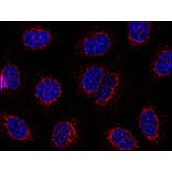 Immunocytochemistry - Anti-STIM1 Antibody [CDN3H4] (A86626) - Antibodies.com
