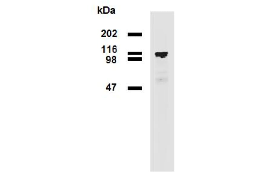 Western Blot - Anti-PDE8A Antibody [EM-52] (A86629) - Antibodies.com