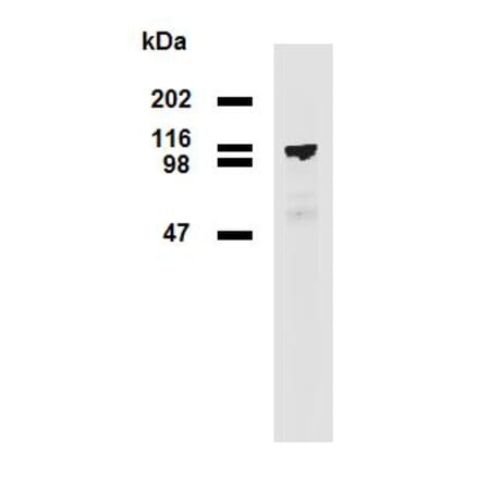 Western Blot - Anti-PDE8A Antibody [EM-52] (A86629) - Antibodies.com