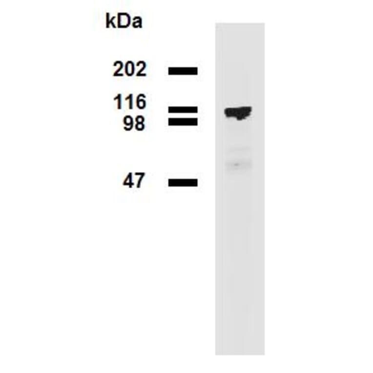 Western Blot - Anti-PDE8A Antibody [EM-52] (A86629) - Antibodies.com