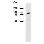 Western Blot - Anti-PDE8A Antibody [EM-52] (A86629) - Antibodies.com