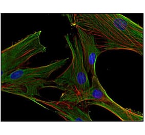 ICC - Anti-Clathrin Heavy Chain Antibody [BF-06] (A86631)