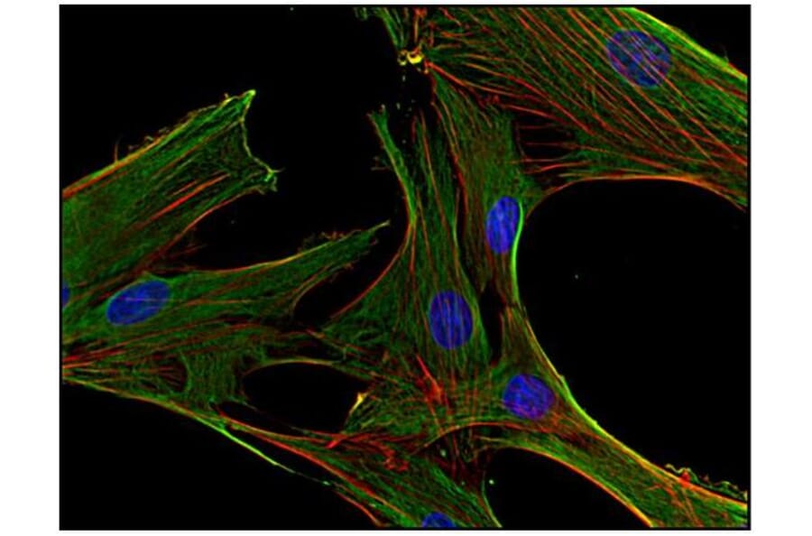ICC - Anti-Clathrin Heavy Chain Antibody [BF-06] (A86631)