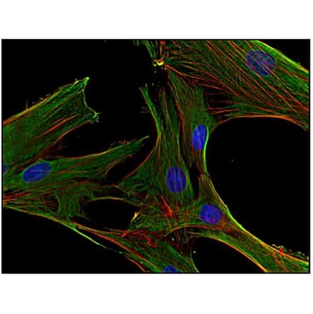 ICC - Anti-Clathrin Heavy Chain Antibody [BF-06] (A86631)