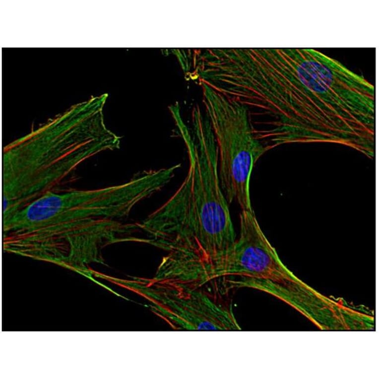 ICC - Anti-Clathrin Heavy Chain Antibody [BF-06] (A86631)