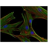 ICC - Anti-Clathrin Heavy Chain Antibody [BF-06] (A86631)