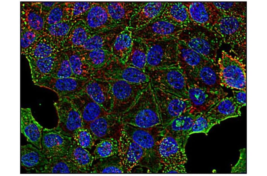 ICC - Anti-Clathrin Heavy Chain Antibody [BF-06] (A86631)