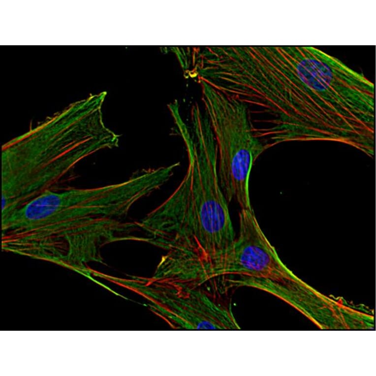Immunocytochemistry - Anti-Clathrin Heavy Chain Antibody [BF-06] (A86631) - Antibodies.com