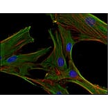 Immunocytochemistry - Anti-Clathrin Heavy Chain Antibody [BF-06] (A86631) - Antibodies.com