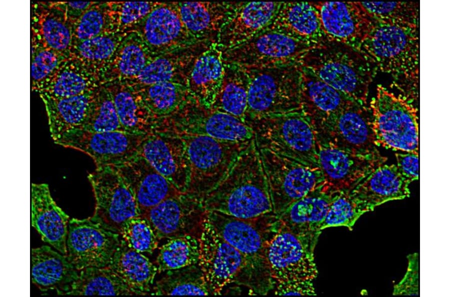 Immunocytochemistry - Anti-Clathrin Heavy Chain Antibody [BF-06] (A86630) - Antibodies.com
