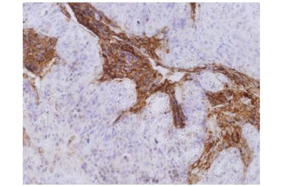 IHC - Anti-Carcino Embryonic Antigen CEA Antibody [CB30] (A86638)